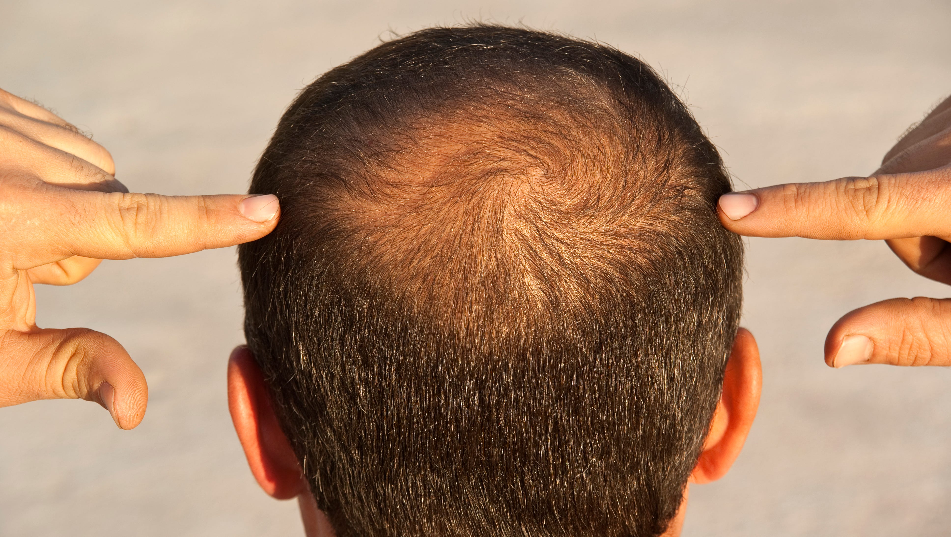 روش‌های موثر در ترميم و جوانسازی مو